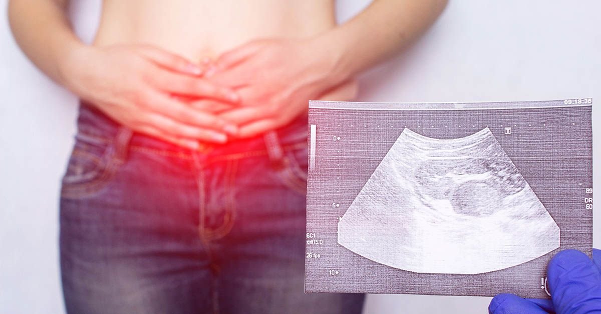 Consulta de Segunda Opinión - Centro de la Hernia de Tijuana