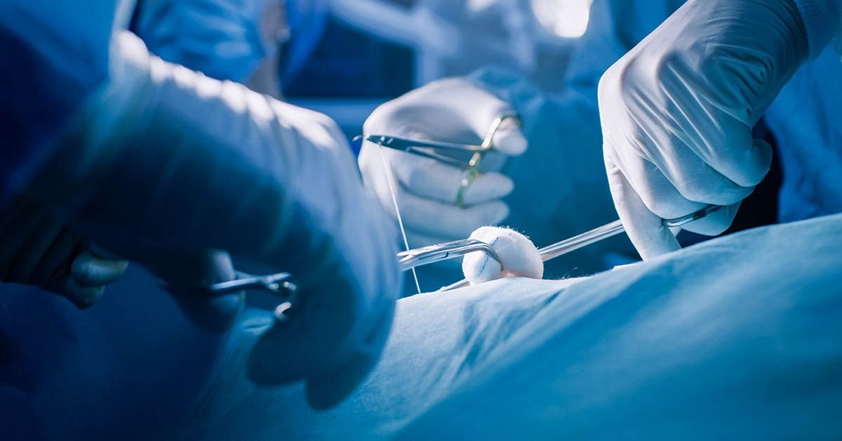 Hernia Femoral - Centro de la Hernia de Tijuana